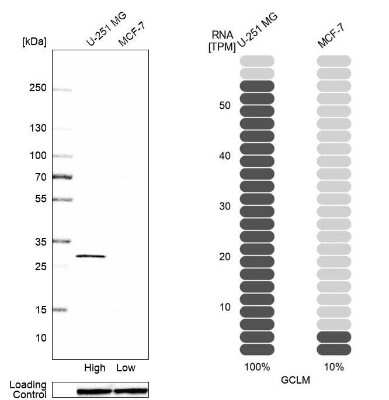 Western Blot: GCLM Antibody [NBP1-83361]