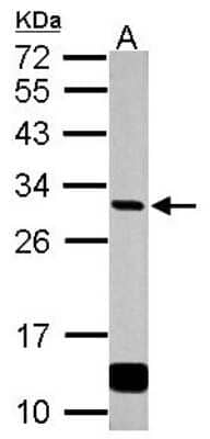 Western Blot: GCLM Antibody [NBP2-16624]