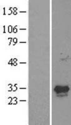 Western Blot: GCLM Overexpression Lysate [NBL1-11012]