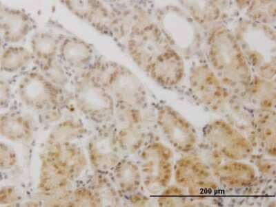 Immunohistochemistry-Paraffin: GCM1 Antibody (2E11) [H00008521-M05]