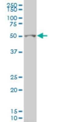 Western Blot: GCM1 Antibody (2E11) [H00008521-M05]