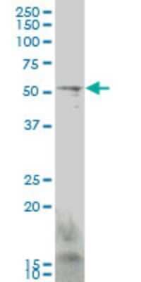 Western Blot: GCM1 Antibody (3D3) [H00008521-M06]