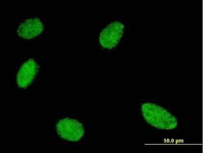 Immunocytochemistry/ Immunofluorescence: GCM1 Antibody (3G7) [H00008521-M03]