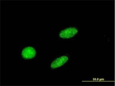 Immunocytochemistry/ Immunofluorescence: GCM1 Antibody (4C11) [H00008521-M02]