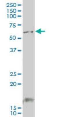 Western Blot: GCM1 Antibody (4E8) [H00008521-M04]