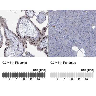 Immunohistochemistry-Paraffin: GCM1 Antibody [NBP3-17006]