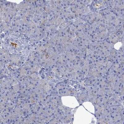 Immunohistochemistry-Paraffin: GCM1 Antibody [NBP3-17006]