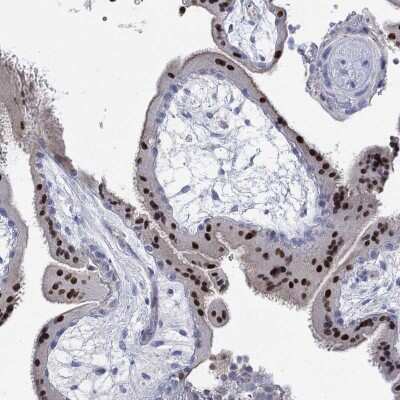 Immunohistochemistry-Paraffin: GCM1 Antibody [NBP3-17006]