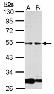 Western Blot: GCM1 Antibody [NBP2-14966]