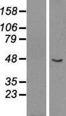 Western Blot: GCM1 Overexpression Lysate [NBP2-07969]