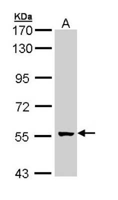 Western Blot: GCM2 Antibody [NBP1-33040]