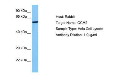 Western Blot: GCM2 Antibody [NBP2-86649]