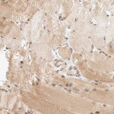 Immunohistochemistry-Paraffin: GCN1L1 Antibody [NBP1-83381]