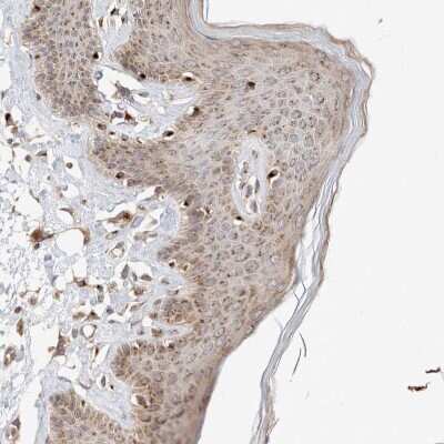 Immunohistochemistry-Paraffin: GCN1L1 Antibody [NBP1-83381]