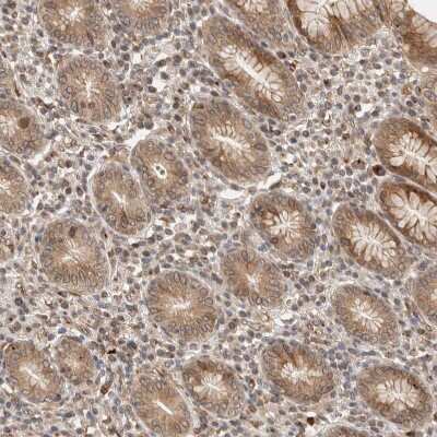 Immunohistochemistry-Paraffin: GCN1L1 Antibody [NBP1-83381]
