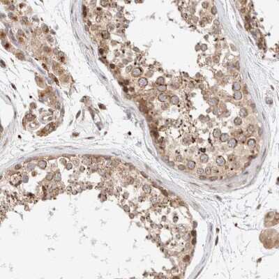 Immunohistochemistry-Paraffin: GCN1L1 Antibody [NBP1-83381]