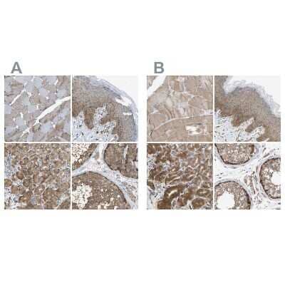 Immunohistochemistry-Paraffin: GCN1L1 Antibody [NBP1-83383]