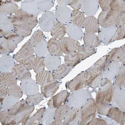 Immunohistochemistry-Paraffin: GCN1L1 Antibody [NBP1-83383]