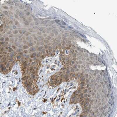 Immunohistochemistry-Paraffin: GCN1L1 Antibody [NBP1-83383]