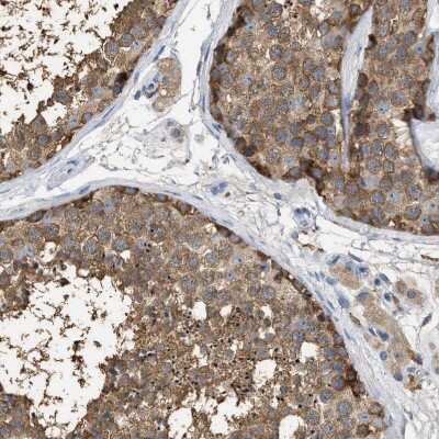 Immunohistochemistry-Paraffin: GCN1L1 Antibody [NBP1-83383]