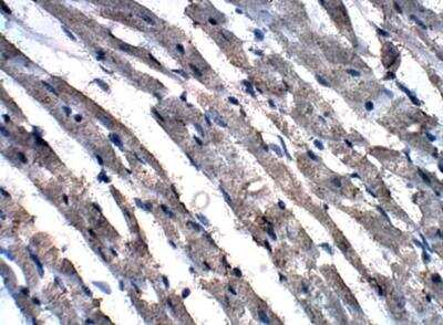 Immunohistochemistry-Paraffin: GCN2 Antibody [NBP3-12273]