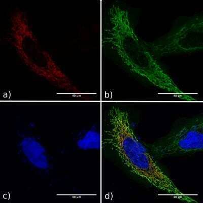 Immunocytochemistry/ Immunofluorescence: GCN4 Antibody (C11L34) - Azide and BSA Free [NBP2-81273]