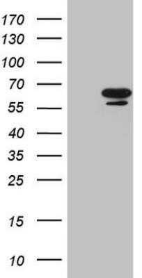 Western Blot: GCNF/NR6A1 Antibody (OTI6F3)Azide and BSA Free [NBP2-70825]