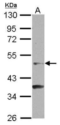 Western Blot: GCNF/NR6A1 Antibody [NBP2-16625]