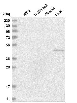 Western Blot: GCNF/NR6A1 Antibody [NBP2-54922]