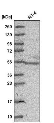 Western Blot: GCNF/NR6A1 Antibody [NBP2-55277]