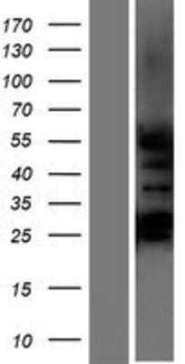 Western Blot: GCNF/NR6A1 Overexpression Lysate [NBP2-10976]