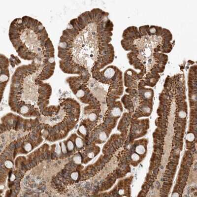 Immunohistochemistry-Paraffin: GCNT2 Antibody [NBP1-88781]