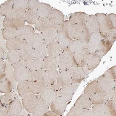 Immunohistochemistry-Paraffin: GCNT2 Antibody [NBP1-88781]