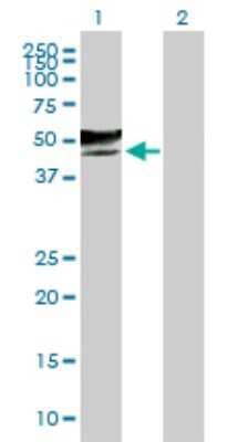 Western Blot: GCNT2 Antibody [H00002651-B01P]