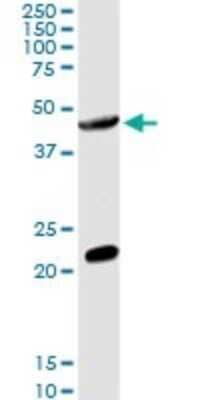 Western Blot: GCNT2 Antibody [H00002651-D01P]