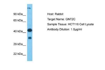 Western Blot: GCNT2 Antibody [NBP2-87491]