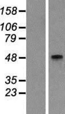 Western Blot: GCNT2 Overexpression Lysate [NBP2-05479]