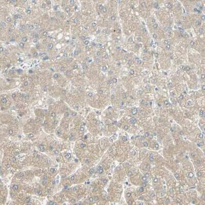 Immunohistochemistry-Paraffin: GCNT3 Antibody [NBP1-88313]