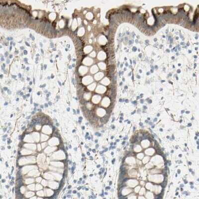 Immunohistochemistry-Paraffin: GCNT3 Antibody [NBP1-88313]