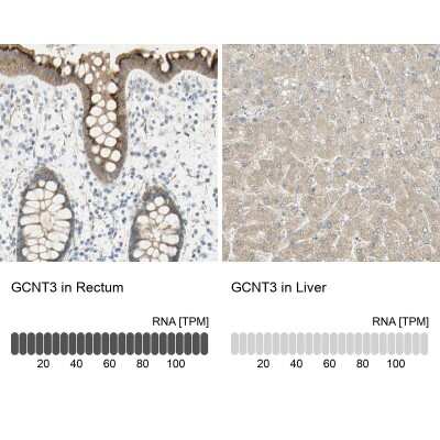 Immunohistochemistry-Paraffin: GCNT3 Antibody [NBP1-88313]