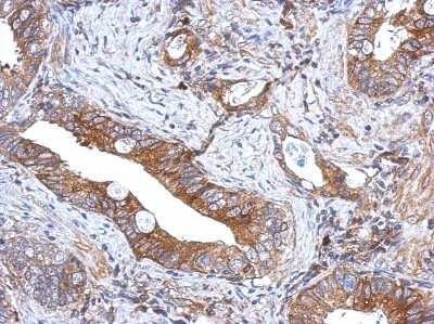 Immunohistochemistry-Paraffin: GCNT3 Antibody [NBP2-16626]