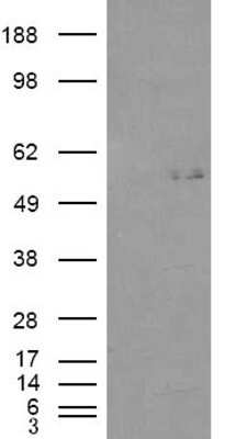 Western Blot: GCNT3 Antibody [NB100-93400]