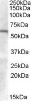 Western Blot: GCNT3 Antibody [NB100-93401]
