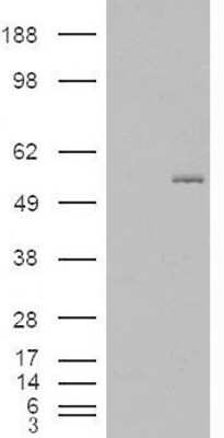 Western Blot: GCNT3 Antibody [NB100-93401]