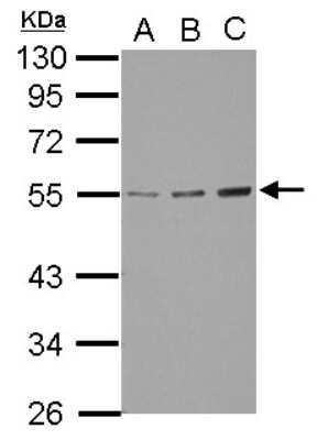 Western Blot: GCNT3 Antibody [NBP2-16626]