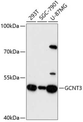 Western Blot: GCNT3 AntibodyAzide and BSA Free [NBP3-04915]