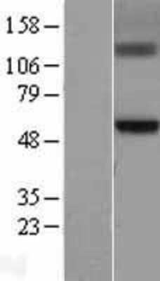 Western Blot: GCNT3 Overexpression Lysate [NBL1-11016]