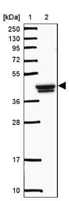 Western Blot: GCNT7 Antibody [NBP2-49055]