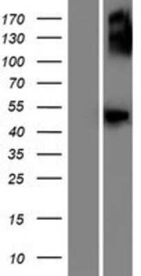 Western Blot: GCNT7 Overexpression Lysate [NBP2-09957]