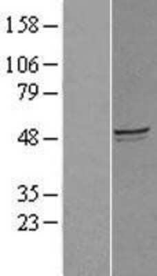 Western Blot: GCOM1 Overexpression Lysate [NBL1-11017]